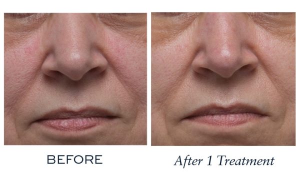 Visibly improved the appearance of age spots and hyper-pigmentation on skin